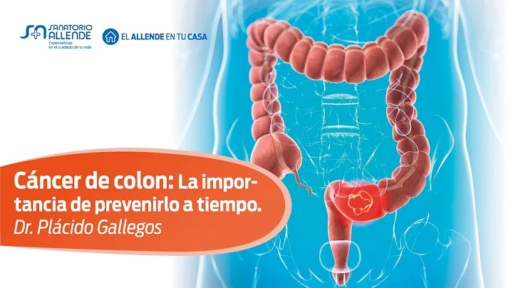 Cncer de colon: La importancia de prevenirlo a tie...