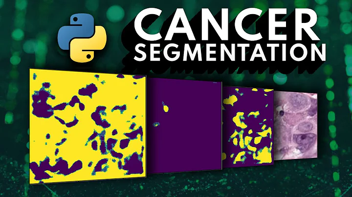 I tried building an ML Cancer Segmentation API in ...