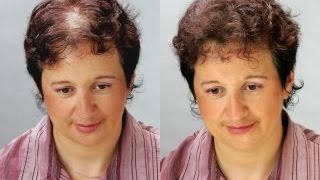 Выпадение волос у женщины 50 лет причины ✪✪✪✪✪ видео Мифы о лечении волос, все о восстановлении и здоровье волос Врач трихолог
