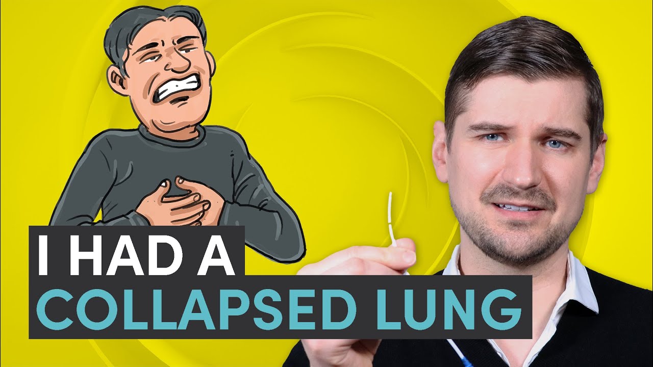 👨‍⚕️ I Had A Collapsed Lung (Pneumothorax) 📢 See Comments For Support & Community