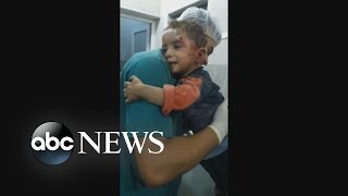 Aleppo Boy Refuses To Let Go Of Nurse Aleppo Boy Refuses To Let Go Of Nurse