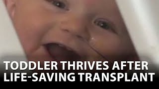 Toddler thrives after life-saving transplant