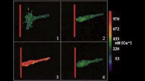 Growth cone guidance by a repulsive substrate (CSPG).mov