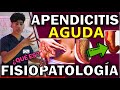 Apendicitis aguda fisiopatologa  guiamed