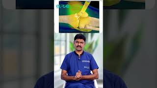 PRP injections for knee pain telugu |Dr Prakash Gudipudi| #prp #prpinjection #prptreatment #kneepain