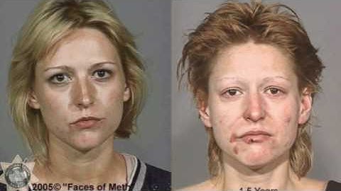 Caras antes y después del consumo de drogas