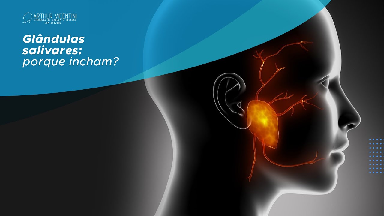 Glândulas salivares: porque incham? | Dr. Arthur Vicentini CRM 154.086