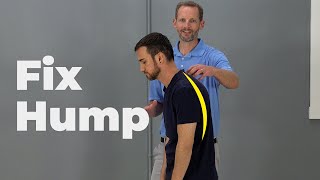 Dowagers Hump Exercises (AKA Hyperkyphosis)