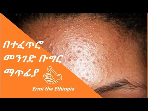 ቪዲዮ: ታይሮይድዎን እንዴት እንደሚፈትሹ 8 ደረጃዎች (ከስዕሎች ጋር)