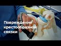 Разрыв передней крестообразной связки. Кому нужна операция артроскопия для восстановления?