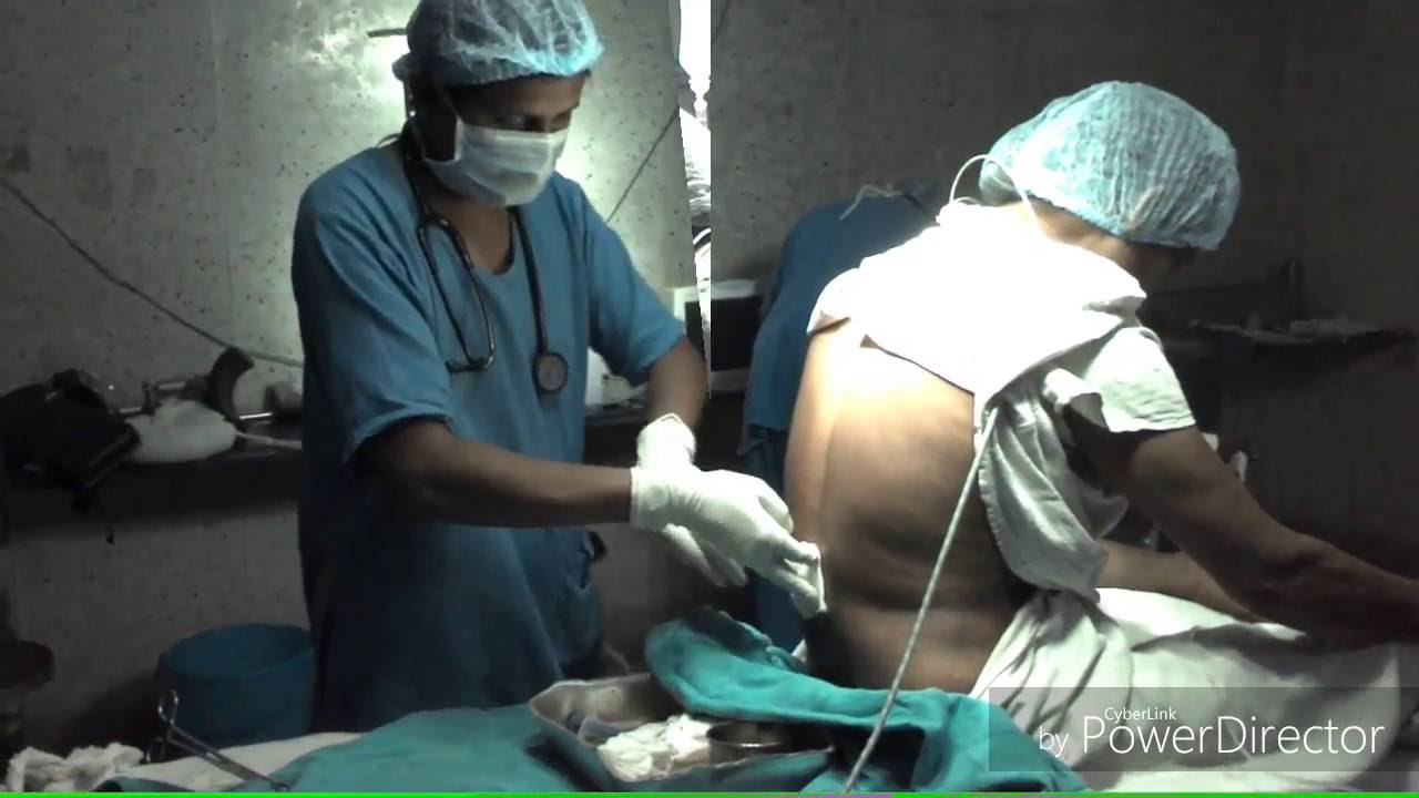 Saddle block YouTube