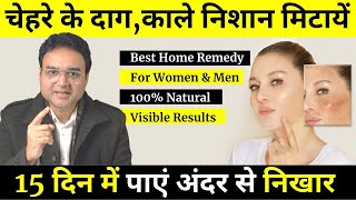 Remove Dark Circles, Dark Spots &amp; Hyperpigmentation Marks With These 2 Remedies (Permanent Solution)