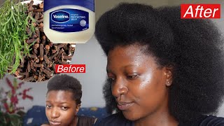 Wow 😮 Mix Vaseline With Cloves & Rosemary And Grow Hair Like Never Before.