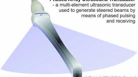 Ultrasound Transducer ANIMATION - Phased-Array Ultrasound Transducer - Principle of Operation
