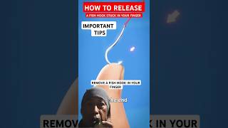 How To Remove A Fish Hook Stuck On Your Finger