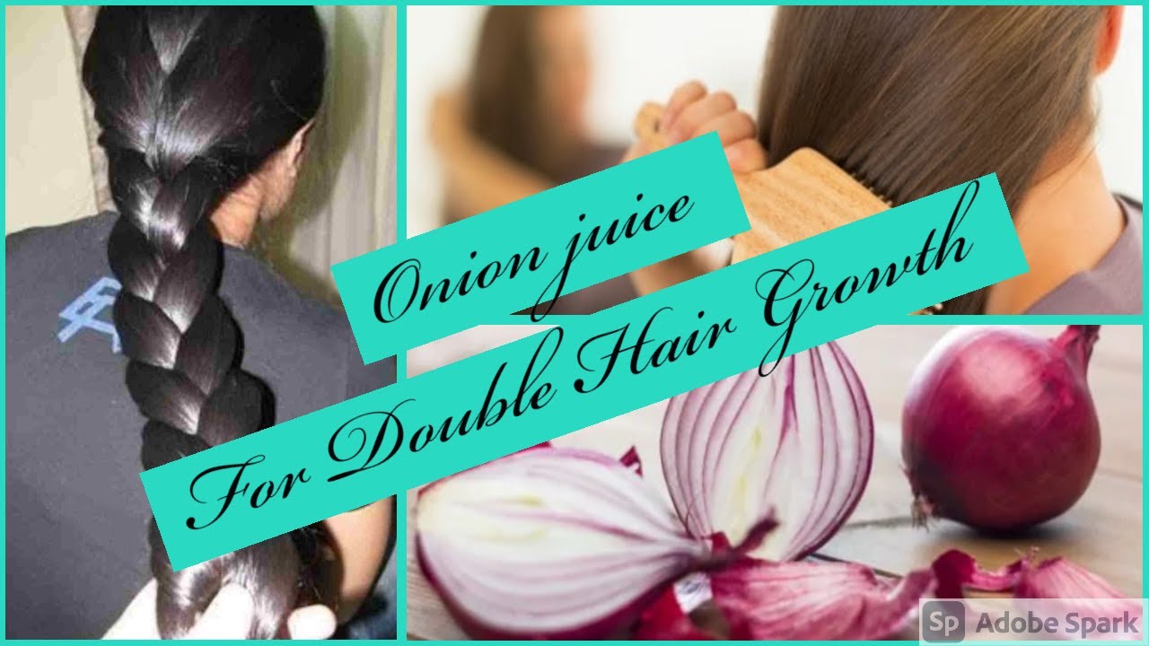 Onion juice,Rice water Double hair Growth itchy scalp,dandruff,hair