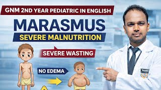 Marasmus gnm 2nd year pediatric in hindi