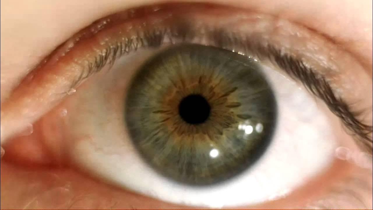 Глаза двигаются. Толчкообразный нистагм. Зрачки расширяются гиф. Дрожит глаз что это. Мелкоразмашистый горизонтальный нистагм.