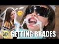 WATCH ME GETTING MY BRACES PUT ON FOR THE FIRST TIME | FULL LIFE CHANGING PROCEDURE| PHILLIPS FamBam