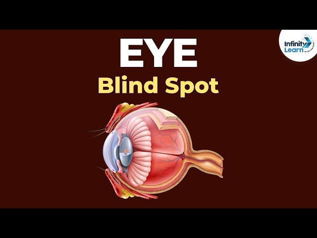 What is the blind spot in eye?