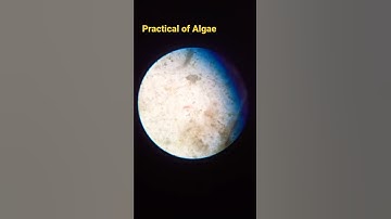 practical of algae || algae in micro bacteria prasent|| Botany lab 🧪🧫|| microscope 🔬