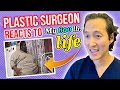 Plastic Surgeon Reacts to MY 600 LB LIFE - One Man's Journey - Dr. Anthony Youn