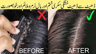 How to Get Rid of Dandruff Flakes Permanently with Homemade Dandruff Removal Remedy Urdu Hindi