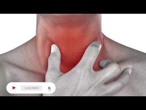 Video: Si të lehtësoni shpejt dhimbjen e fytit (me fotografi)