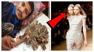 5 अनोखे लोग जिन्हे देखकर हिल गयी थी दुनिया | 5 People you won&#39;t believe exist 😱