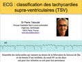 6a. Classification des tachycardies supraventriculaires. ECG. P Taboulet