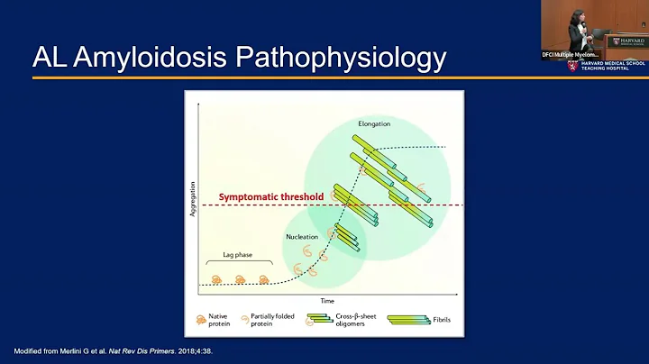 Updates on AL Amyloidosis Treatment: What’s New in 2025