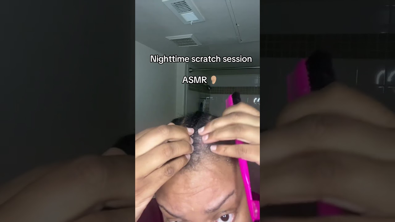 Scratch Session #asmr #scalp #skincare #viral #youtube 