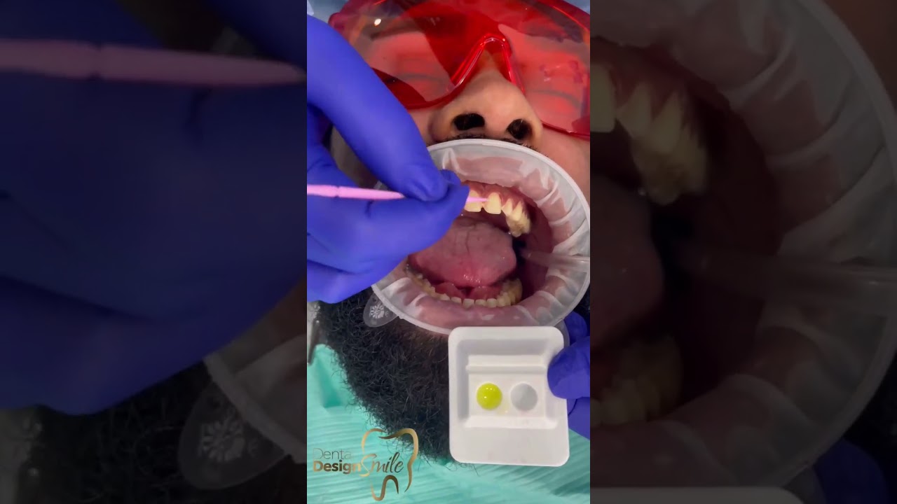 Full process, you have to see it