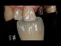 How To Mimic Natural Teeth | Dental Lab Technician Learning