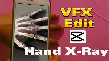 Hand X-Ray Edit Using CAPCUT App | Vfx Edit | Video Edit Tutorial