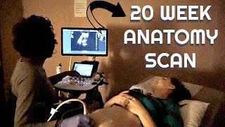 20 Week Ultrasound