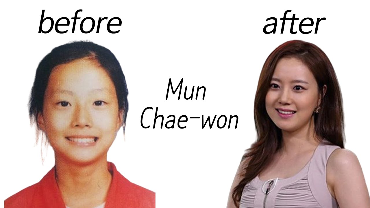 Mun Chae-won, ë¬¸ì±„ì›�, before, ë¹„í�¬, after, ì• í”„í„°.