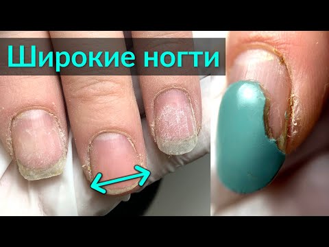Как исправить ШИРОКИЕ НОГТИ с помощью наращивания подходящей ФОРМЫ
