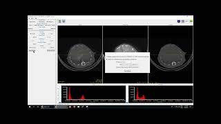 Protocol Tutorial   Preprocessing Data