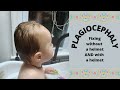 UNDERSTANDING PLAGIOCEPHALY (AND TORTICOLLIS)| HOW TO TREAT AND PREVENT FLAT HEAD SYNDROME