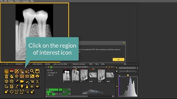 Mediadent v8 : Region of interest