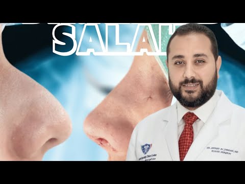 تجميل الأنف اعرف ازاى بنعمل العملية ونحصل على شكل أنف جميل