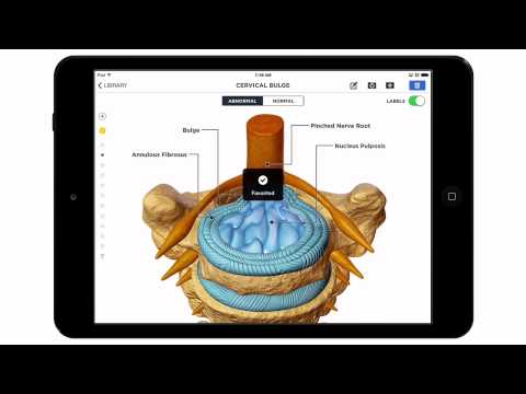 How to Use