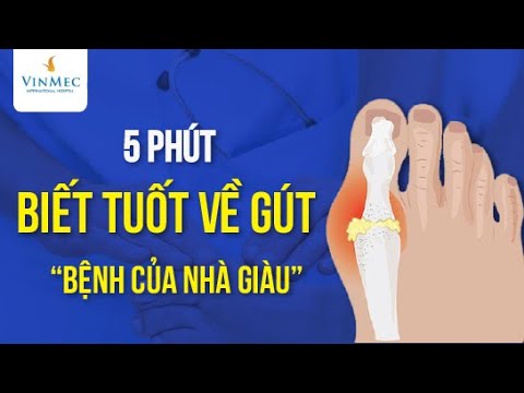 Video: Cách phân biệt bệnh gút với các tình trạng tương tự: 15 bước