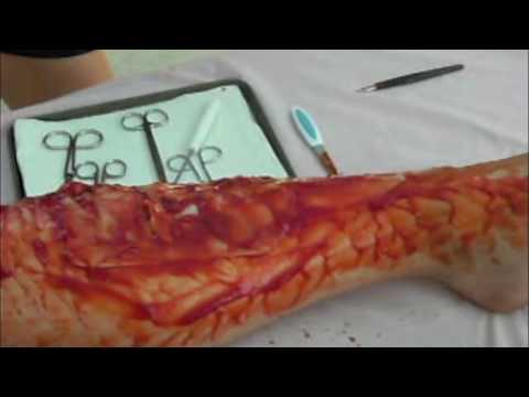 Surgery- Haley Henry