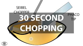 30 Second Phaco Chop Explanation