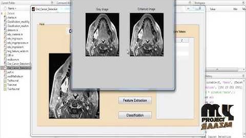 Comparison of Feature Extraction Techniques-classify Oral Cancers | Final Year Projects 2016 - 2017