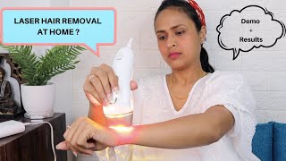 LASER HAIR REMOVAL AT HOME? IPL Review & Results (5+ Weeks) | Braun Silk Expert 5