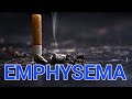 Emphysema ,respiratory disorder,#biology
