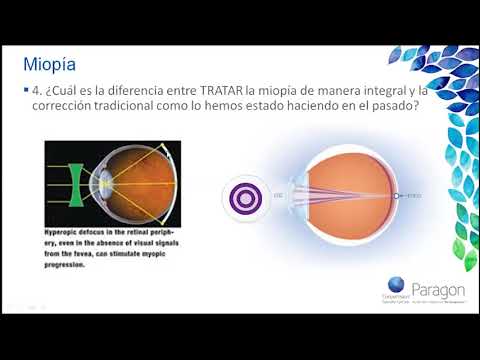 Preguntas y Respuestas sobre la Epidemia de la Miopía.